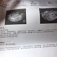 看孕囊能知道是男孩还是女孩吗👧