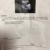 孕6周6天，因为出血去医院，医生b超说没有孕囊，问我是不是掉出东西了。第一次怀孕的我当场就泪奔了……...