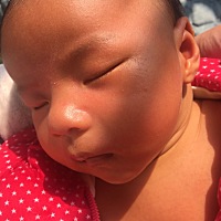 孩子黄疸还是有，在吃几天药，不行就去医院照蓝光，请宝妈们指教