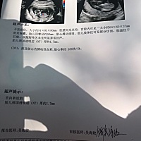 你是佩奇还是乔治呢