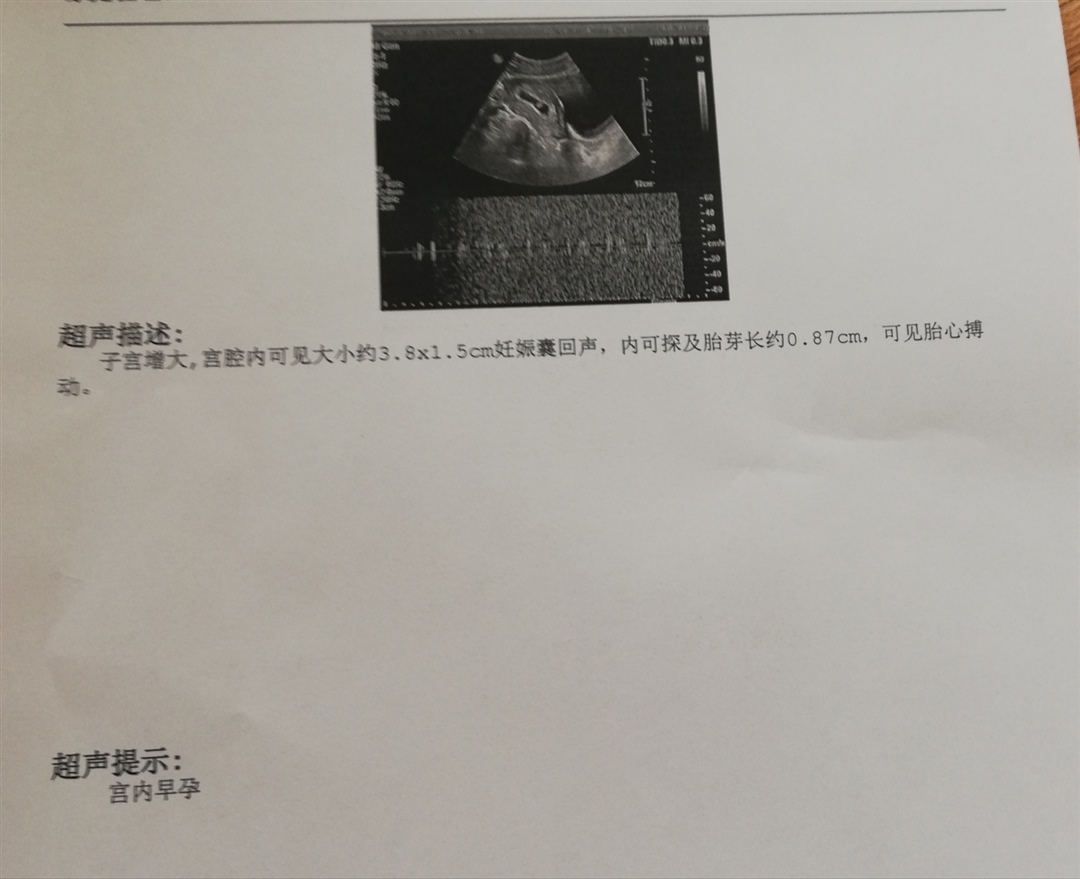 1月31号做的检查，下次多久后呢