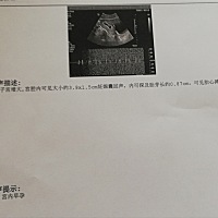 这个怎么看， 1月31号做的检查，下次多久后呢