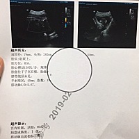 请问能看的出来是乔治还是佩奇吗？