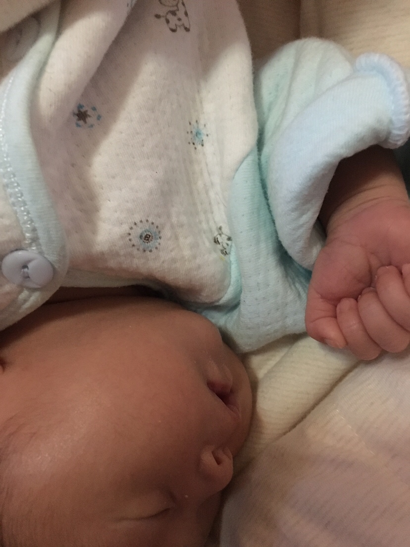 还有就是这个侧面看 会不会是上颌突出 骨性baoya