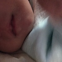 宝马车们，你们知不知道宝宝嘴巴下面这两个白白的鼓起来是为什么啊 生下来就是这样 还有就是这个侧面看 ...