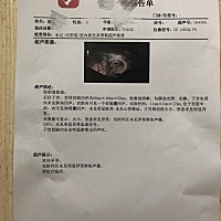 新晋孕妈25岁。12周开始出现头痛症状！身边都是小年轻.请问一下这是正常吗 ？图片是刚怀上的时候