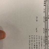 除开焦虑没别的，小腹难受。。。等做彩阴超