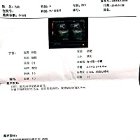 10周拍得B超，有点好奇是佩奇还是乔治