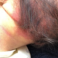 宝宝脑袋这红红的是啥？