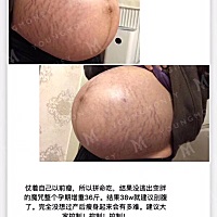 产后恢复打卡，🤪这波能量绝对正