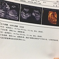 别人问我家是不是有矿，二胎