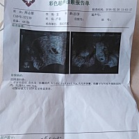 孕酮太低是什么起的呢