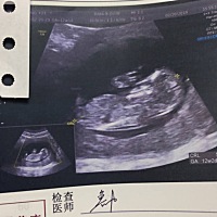粗心大猪蹄子把产检的单子和病历本都搞丢了，就只有手机里拍照的彩超图片了，好可爱的赶脚，不知道会是...