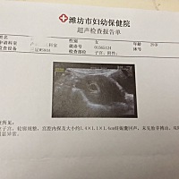 孕7周没有胎心胎芽，这样有问题吗？医生让过2周去复查😔