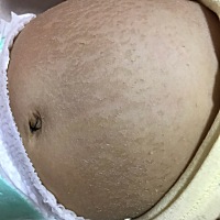 有人知道这是怎么回事吗？只有肚皮，每天有擦橄榄油，还是这样