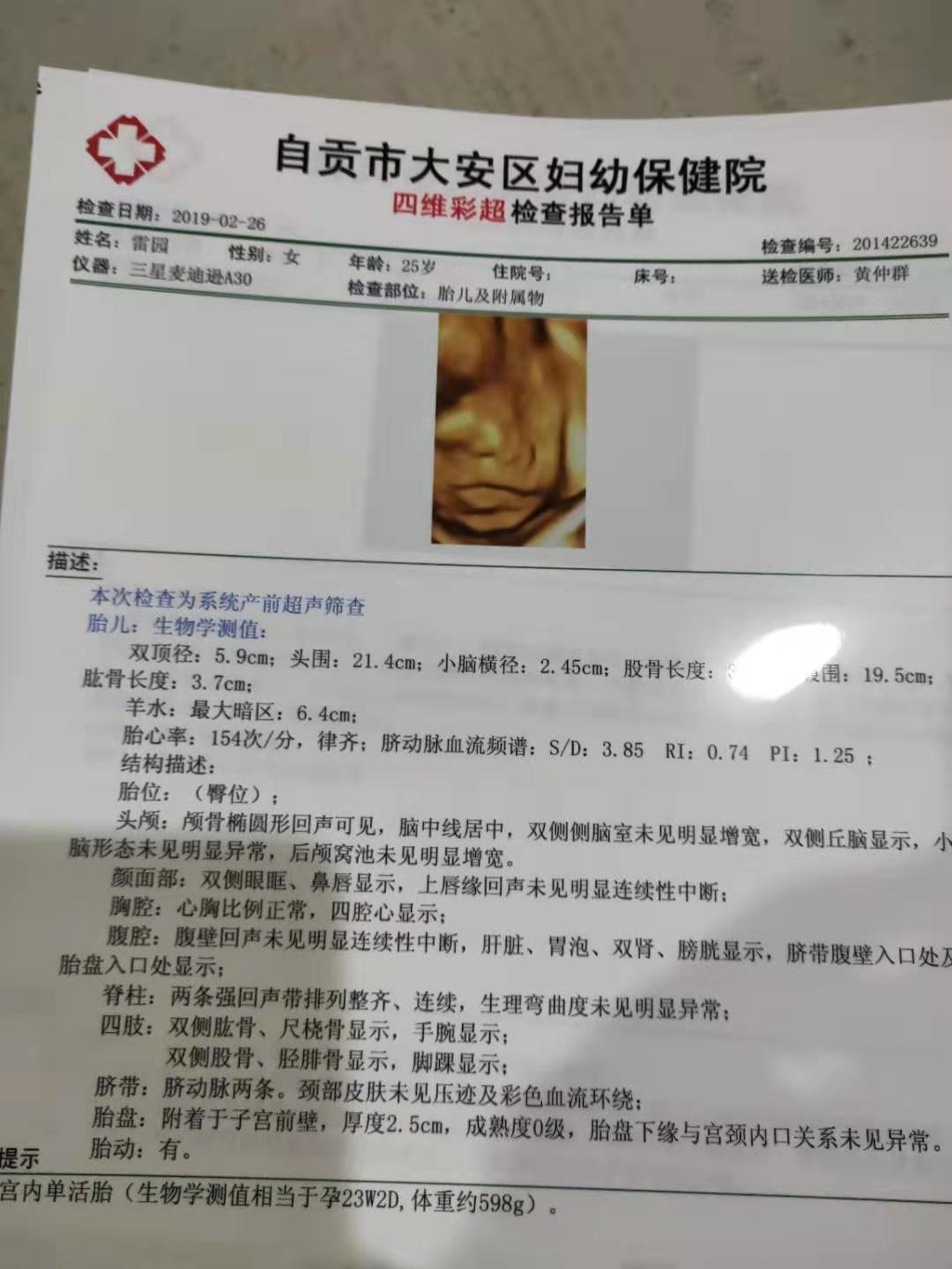 亲们看看是佩奇还是乔治呢