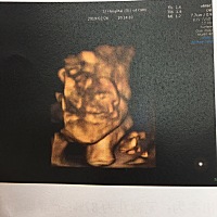 思维一次通过，二宝一切都好