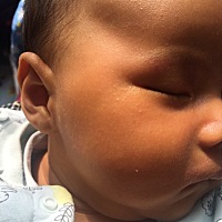 孩子36天了黄疸值17.6还是很高呀，今天带孩子去医院了，医生让照蓝光，我舍不得，找个个医院的熟人，让...