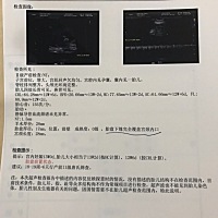 有没有哪位宝妈跟我一样 13周做NT时被告知胎盘下缘完全覆盖宫颈口的？后期还能不能上移？会影响宝宝吗？
