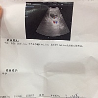 刚拍的B超  能看出男女吗。好奇