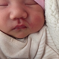 每次母乳。都把宝宝的脸挤红。嘴挤变形。求原因、求方法～～～