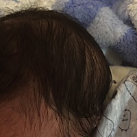 宝宝头上有两个包，宝妈们你们说严重吗