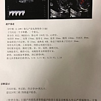 有会看的帮忙看一下吗？不在乎男女 只求健康.