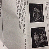 突然有点见红去做了彩超，好在虚惊一场，宝宝没事，有知道男宝女宝的吗？
