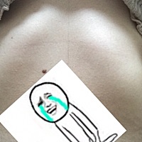 每天都洗澡都没发现，昨天才发现真的左边肋骨凸起好明显，郁闷 百度了下是缺钙 可是我每天有补钙啊……