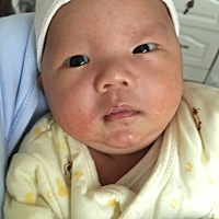 宝宝这几天脸色出现这个.摸起来很粗糙.不知道是怎么回事.而且两天没拉臭臭了.有知道的宝马吗？