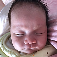 求助各位宝妈，眉毛上的白色结痂是什么，需要处理吗