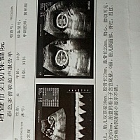 各位宝妈帮忙看看是男宝还是女宝