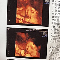 今天刚做了四维、帮忙看看男女、谢谢