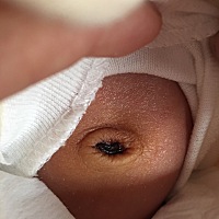 肚脐老是反复流出点血，宝宝都二十多天了还没好，有没有宝妈知道