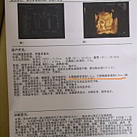有没有宝妈四维时遇到相同情况的啊？医生说让做羊水穿刺或者无创dna，第一次当妈妈，好怕宝宝有什么问题...