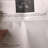 今天去准备唐筛还把四维预约了。一口气花了我1000块。下面那张上面的你们都做过吗？从怀到现在第一次抽...