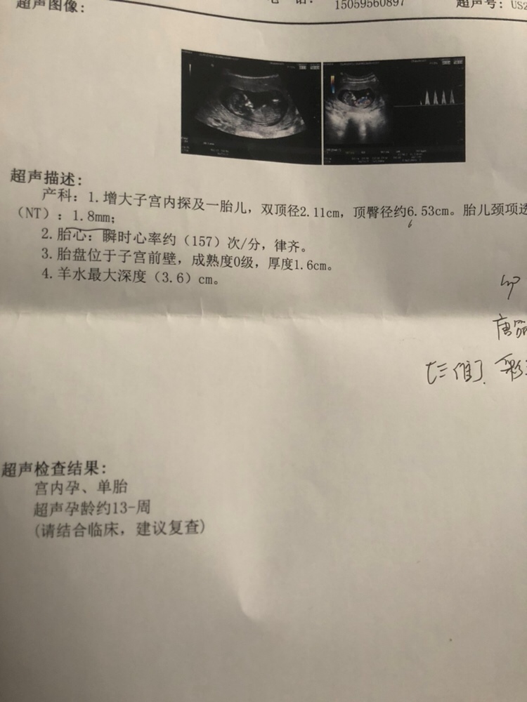 有没有会看的，帮忙看看，