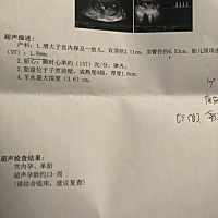 nt可以看男女吗？ 有没有会看的，帮忙看看，