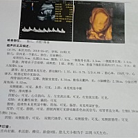 为啥你们就能确定是男的？？？？