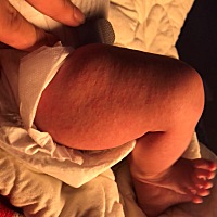 宝妈们、一个月8天宝宝全身红色细小的一颗颗的是什么啊？求解？