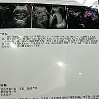 36 2啦，终于快要卸货了，希望一切平安，这是乔治还是佩奇呢？？？？😂