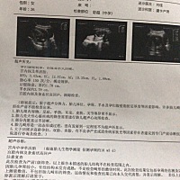 求大家帮忙看下是男孩还是女孩？是头胎但还是挺好奇的