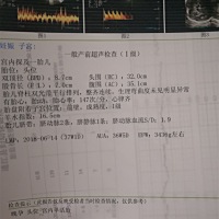 虽然快生了，但还是想知道男女，好奇心就是这么重😄