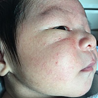 宝宝脸上白白的一粒一粒是怎么回事，怎样才能退