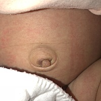 大家帮我看一下这是咋回事，中间部位，谢谢大家