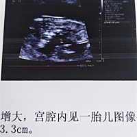 路过的姐姐妹妹求解答，第一次做NT的我有点看不懂，有没有孕妈跟我一样的😔😔