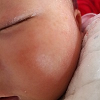 这脸上是什么？怎么能去掉啊？