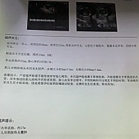 今天17周宝宝做b超，脑子左右囊肿，医生说在复查，等四维报告，有的长长宝宝会吸收的，我真的好担心