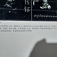 都是我宝宝