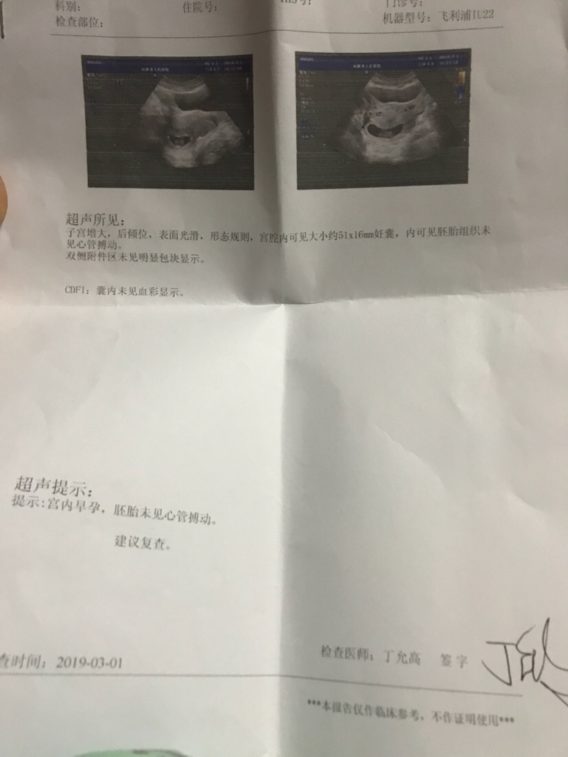 第二次拍